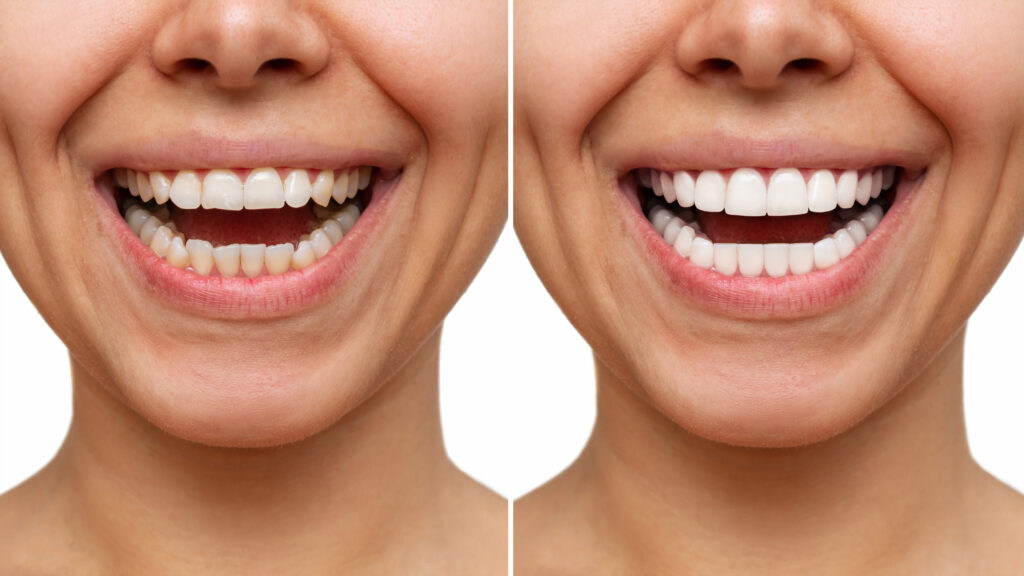 Mouth Cancer Specialist Pune