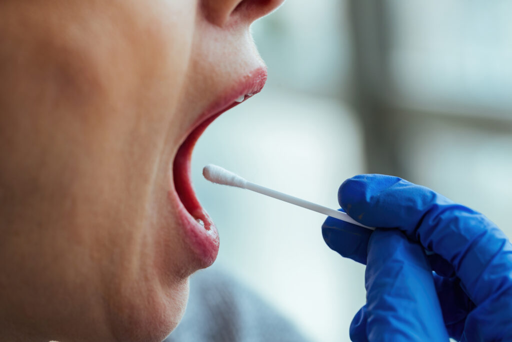 Mouth ulcer close up
