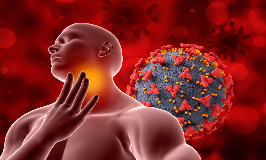 Oral submucous fibrosis illustration